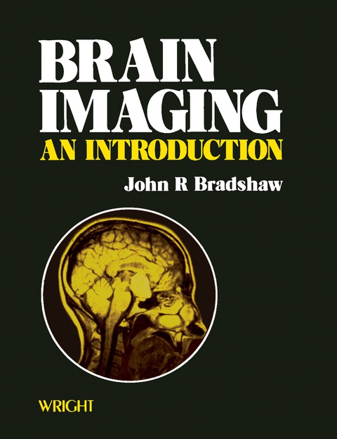 Brain Imaging 