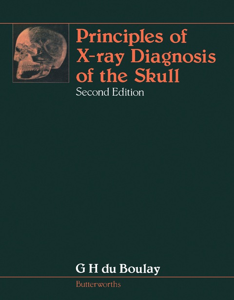 Cover image for book Principles of X-Ray Diagnosis of the Skull