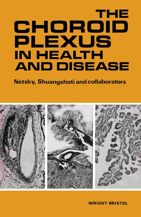 Cover image for book The Choroid Plexus in Health and Disease