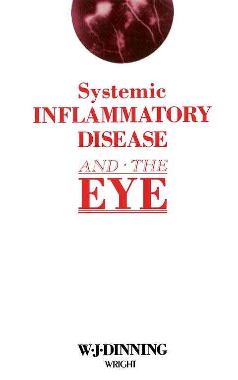 Cover image for book Systemic Inflammatory Disease and the Eye