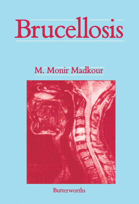 Cover image for book Brucellosis