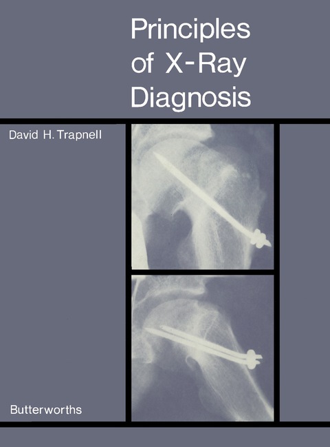 Cover image for book Principles of X-Ray Diagnosis