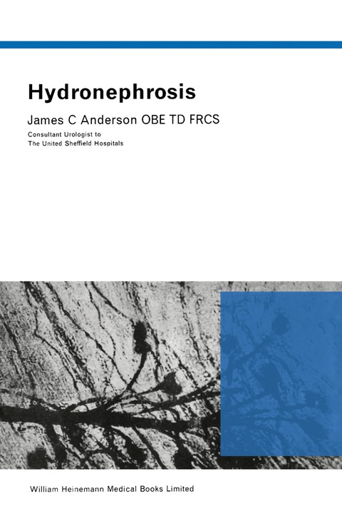 Hydronephrosis 