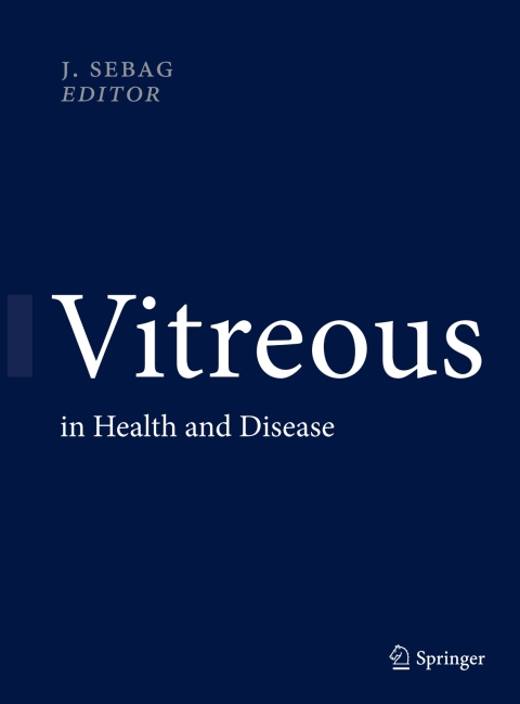 Cover image for book Vitreous