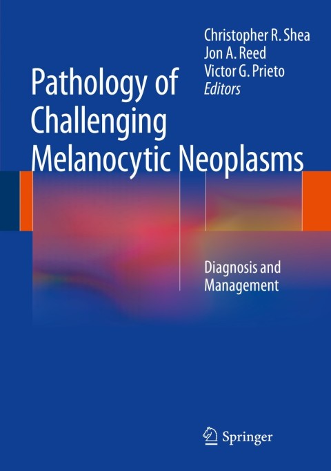 Cover image for book Pathology of Challenging Melanocytic Neoplasms