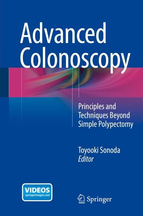Cover image for book Advanced Colonoscopy