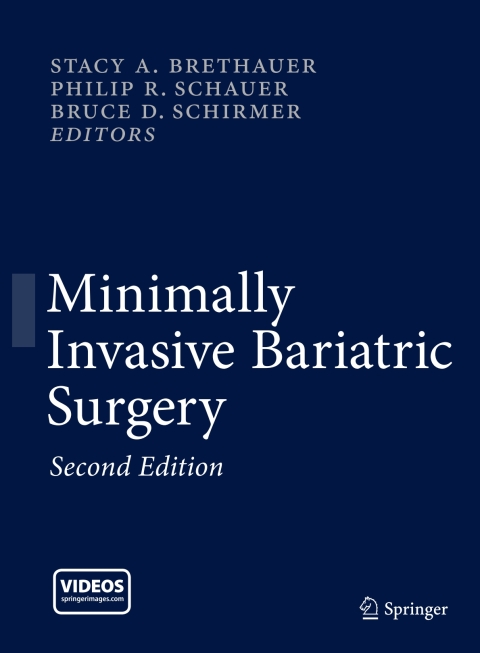 Cover image for book Minimally Invasive Bariatric Surgery