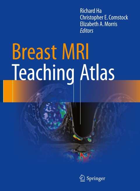 Cover image for book Breast MRI Teaching Atlas