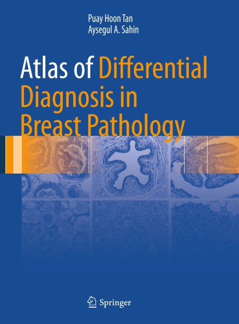 Cover image for book Atlas of Differential Diagnosis in Breast Pathology