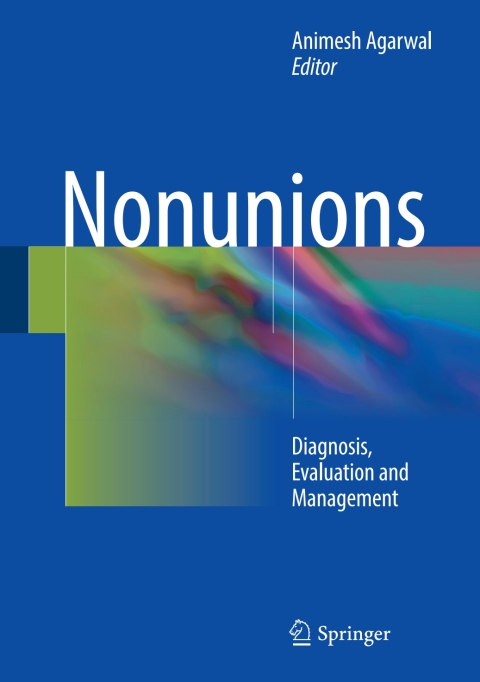 Cover image for book Nonunions