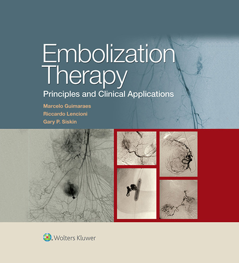 Cover image for book Embolization Therapy: Principles and Clinical Applications