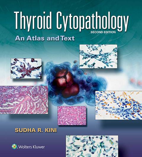 Cover image for book Thyroid Cytopathology