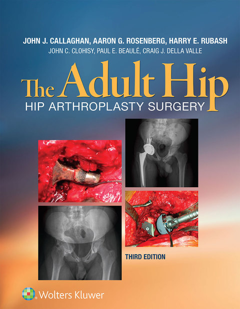 Cover image for book The Adult Hip