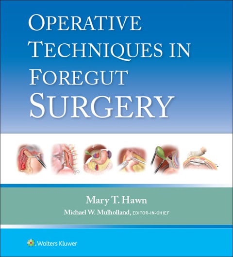 Cover image for book Operative Techniques in Foregut Surgery