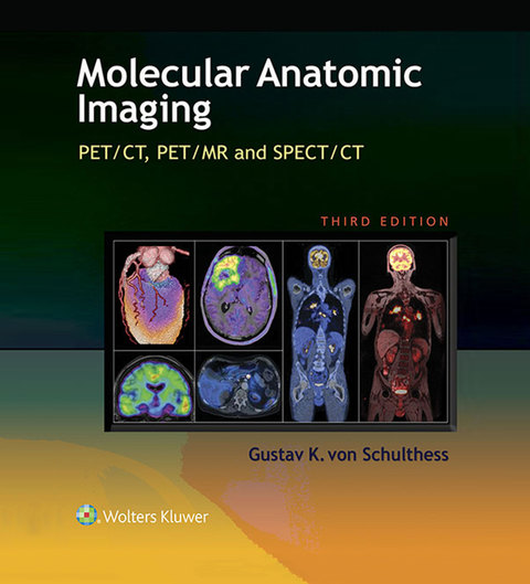 Cover image for book Molecular Anatomic Imaging