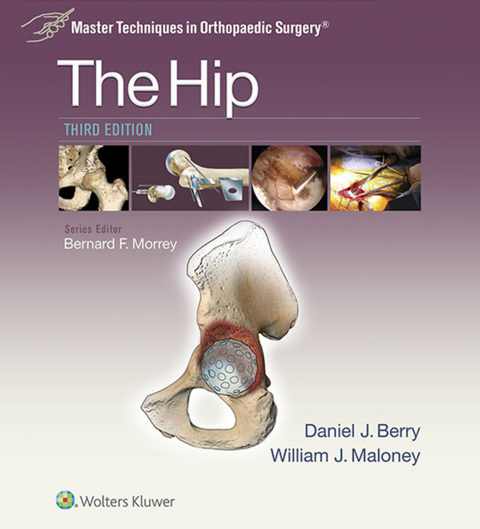 Cover image for book Master Techniques in Orthopaedic Surgery: The Hip