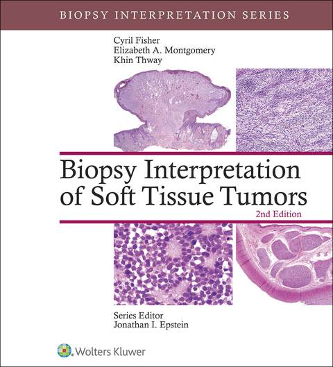 Cover image for book Biopsy Interpretation of Soft Tissue Tumors
