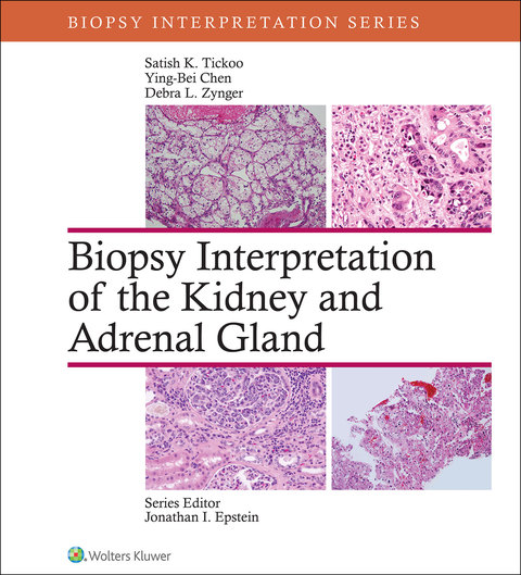 Cover image for book Biopsy Interpretation of the Kidney & Adrenal Gland
