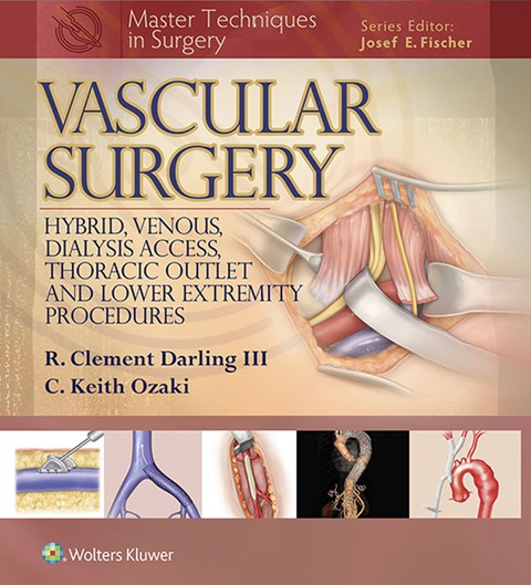 Cover image for book Master Techniques in Surgery: Vascular Surgery: Hybrid, Venous, Dialysis Access, Thoracic Outlet, and Lower Extremity Procedures