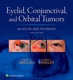 “Eyelid, Conjunctival, and Orbital Tumors: An Atlas and Textbook” (9781496326546)