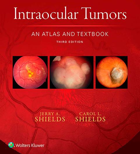 Cover image for book Intraocular Tumors: An Atlas and Textbook