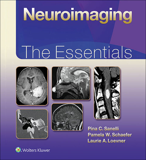 Cover image for book Neuroimaging: The Essentials