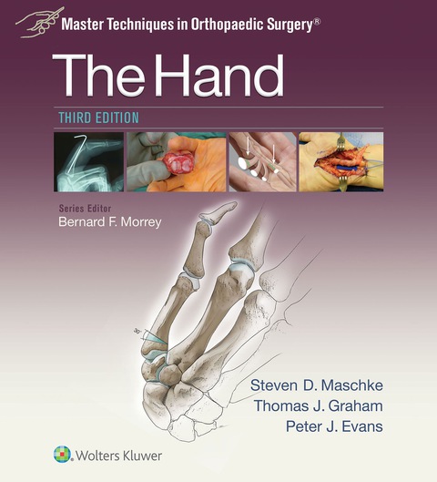 Cover image for book Master Techniques in Orthopaedic Surgery: The Hand