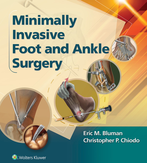 Cover image for book Minimally Invasive Foot & Ankle Surgery