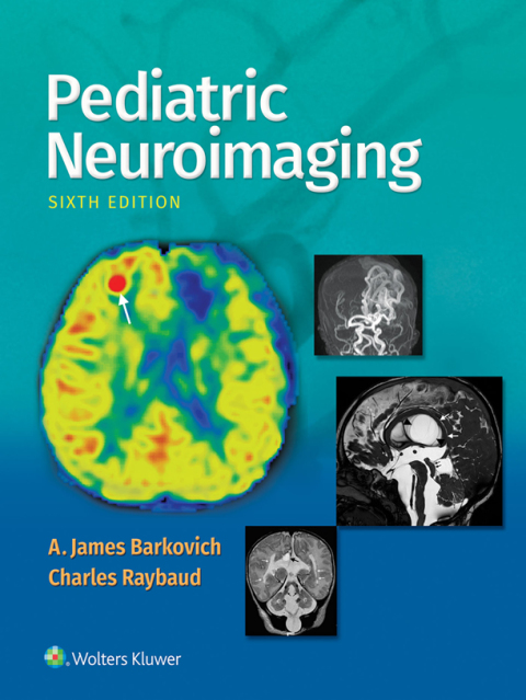 Cover image for book Pediatric Neuroimaging