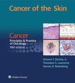 “Cancer of the Skin” (9781496337993)