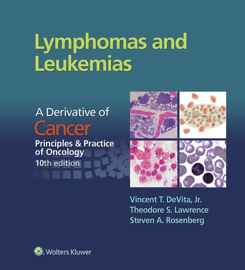 Cover image for book Lymphomas and Leukemias