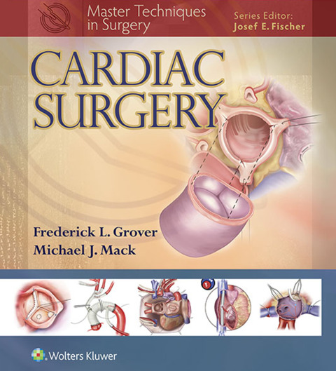 Cover image for book Master Techniques in Surgery: Cardiac Surgery