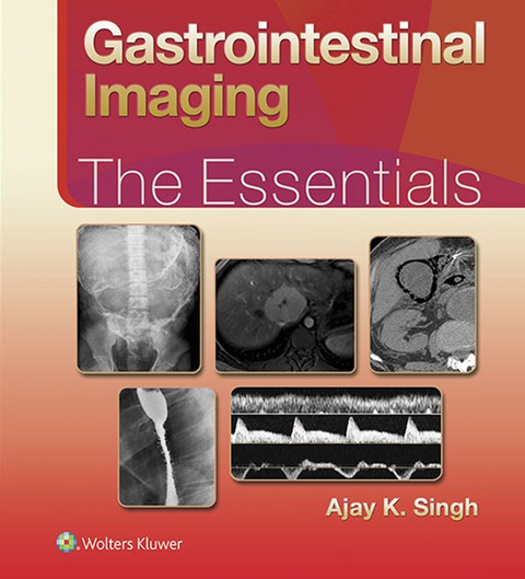 Cover image for book Gastrointestinal Imaging: The Essentials
