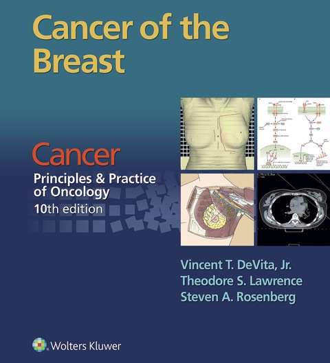 Cover image for book Cancer of the Breast