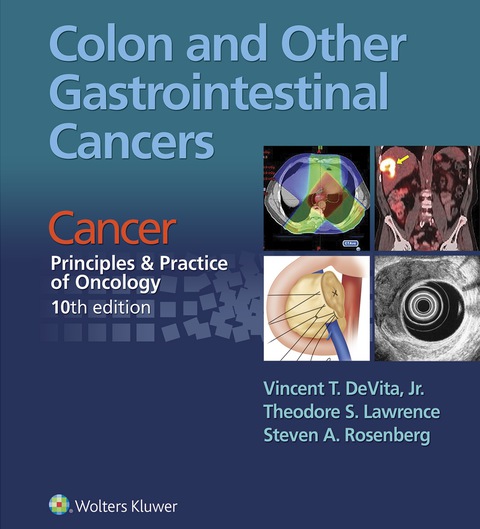 Cover image for book Colon and Other Gastrointestinal Cancers