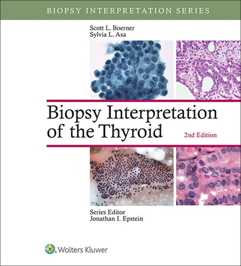 Cover image for book Biopsy Interpretation of the Thyroid