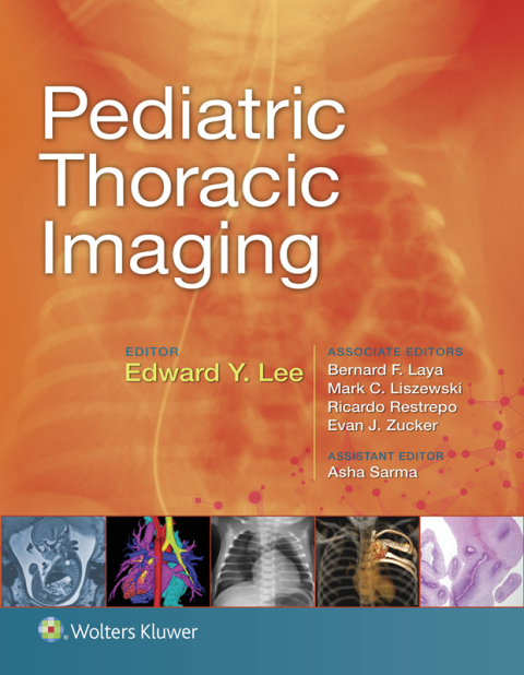 Cover image for book Pediatric Thoracic Imaging