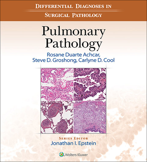 Cover image for book Differential Diagnosis in Surgical Pathology: Pulmonary Pathology