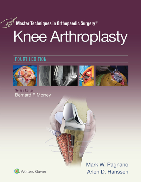 Cover image for book Master Techniques in Orthopedic Surgery: Knee Arthroplasty