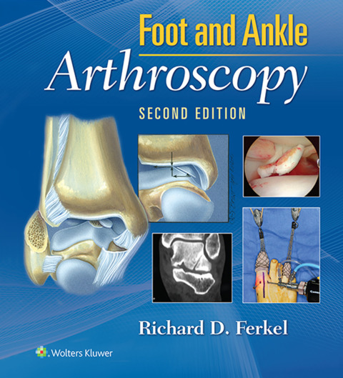 Cover image for book Foot & Ankle Arthroscopy