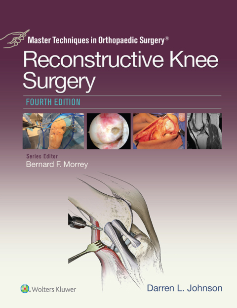 Cover image for book Master Techniques in Orthopaedic Surgery: Reconstructive Knee Surgery