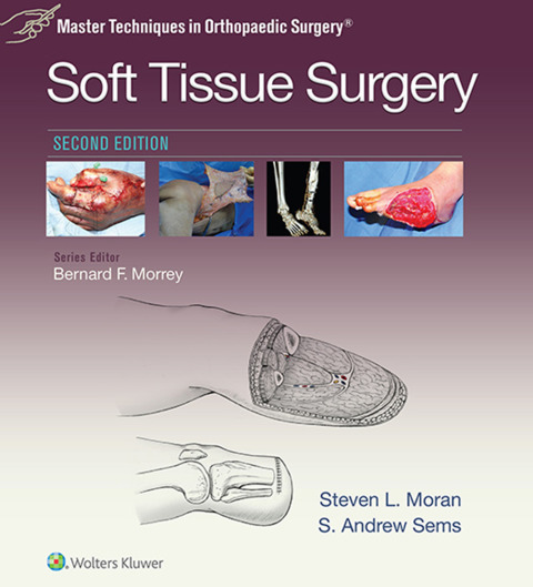 Cover image for book Master Techniques in Orthopaedic Surgery: Soft Tissue Surgery