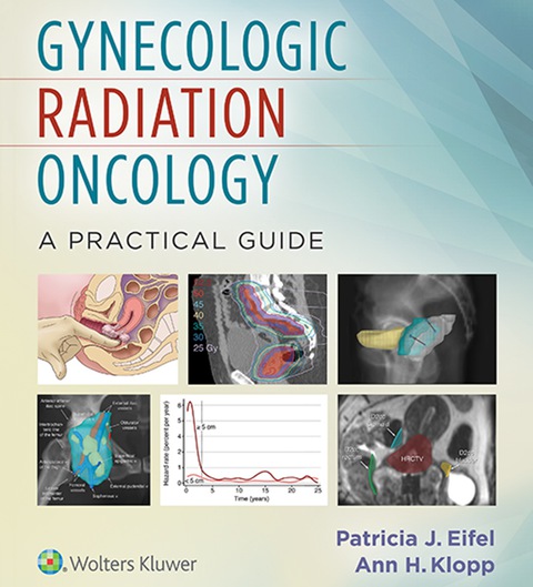 Cover image for book Gynecologic Radiation Oncology: A Practical Guide
