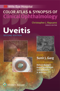 Cover image: Uveitis 2nd edition 9781496363008