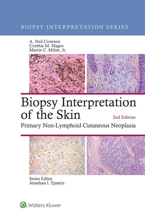 Cover image for book Biopsy Interpretation of the Skin