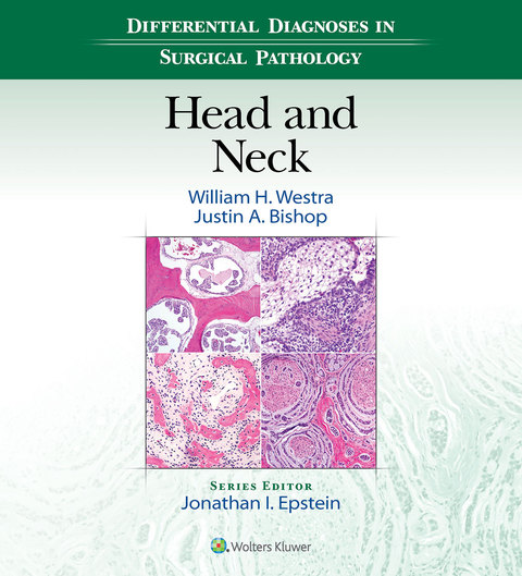 Cover image for book Differential Diagnoses in Surgical Pathology: Head and Neck
