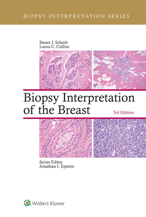 Cover image for book Biopsy Interpretation of the Breast