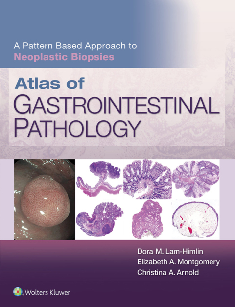 Cover image for book Atlas of Gastrointestinal Pathology: A Pattern Based Approach to Neoplastic Biopsies