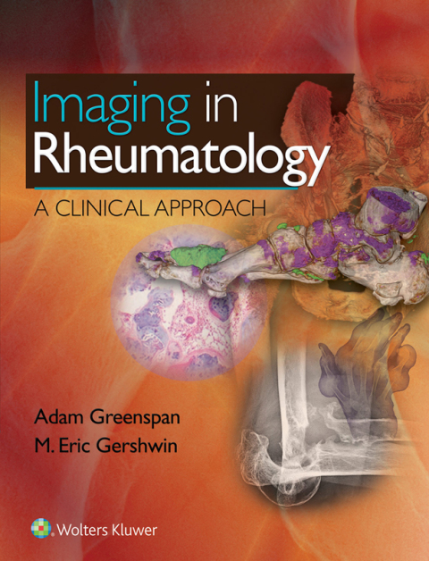 Cover image for book Imaging in Rheumatology