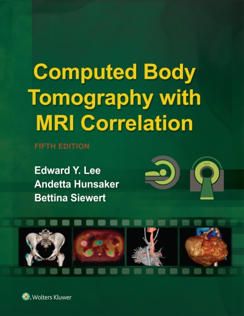Cover image for book Computed Body Tomography with MRI Correlation